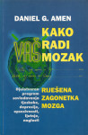 Kako radi vaš mozak