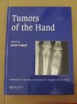 Edited by: Daniel V. Egloff-Tumors of the Hand (NOVO)