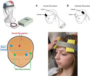 ELEKTROSTIMULATOR MOZGA-BRAIN STIMULATOR, ili TDCS