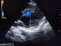 Ultrazvucni Aparat