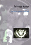 McArdle | Kerr | Boyle (ur.) - Colorectal cancer
