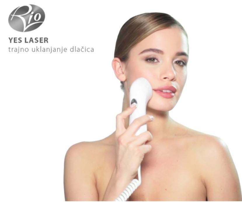 laserski epilator