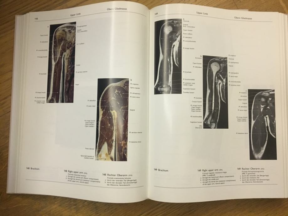 Atlas ljudske anatomije - Atlas of Human Anatomy